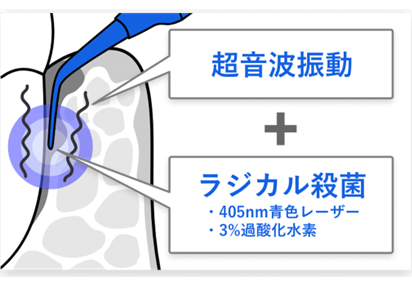 blue_radical03.jpg